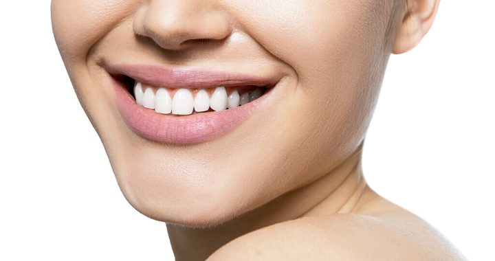 Cum poti obtine dinti mai albi in mod sanatos